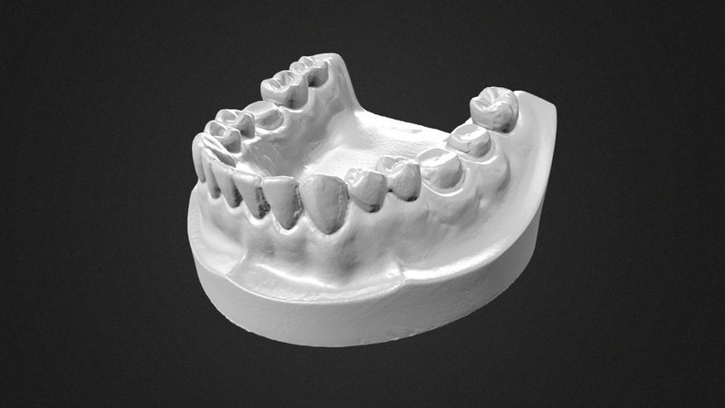 3D DENTAL SCAN SPRAY (12 ea - 1 Box) *Made in Germany (Professional User Only) gallery
