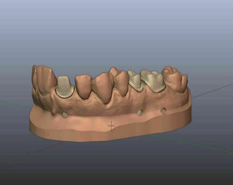 3D DENTAL SCAN SPRAY (12 ea - 1 Box) *Made in Germany (Professional User Only) gallery